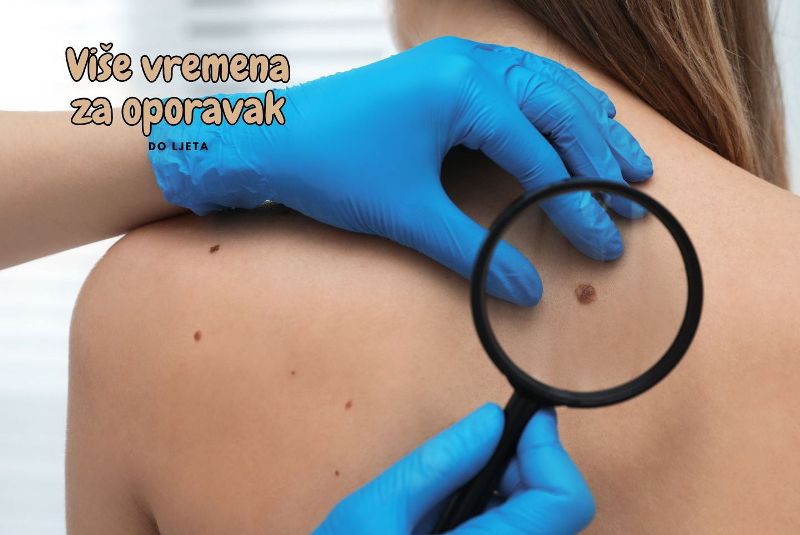 Više vremena za oporavak do ljeta