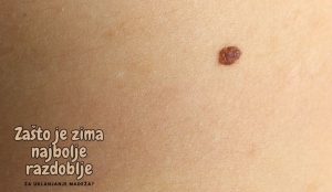 Zašto je zima najbolje razdoblje za uklanjanje madeža?