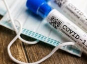 Današnja testiranja pokazala da je još 10 osoba pozitivno na korona virus pa sada imamo 20 osoba oboljelih u Požeško-slavonskoj županiji